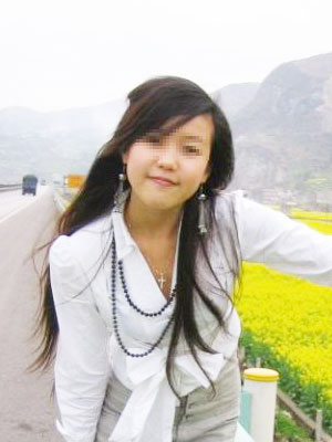 根治狐臭，我选择了佰迪清